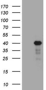 LIMS2 Antibody in Western Blot (WB)