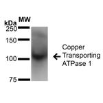 ATP7A Antibody in Western Blot (WB)