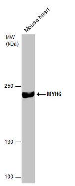 MYH6 Antibody in Western Blot (WB)
