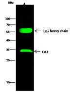 Carbonic Anhydrase III Antibody in Immunoprecipitation (IP)