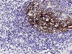 CD23 Antibody in Immunohistochemistry (Paraffin) (IHC (P))