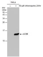 LC3B Antibody in Western Blot (WB)