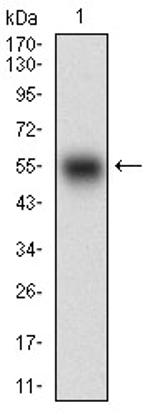 SMCP Antibody in Western Blot (WB)