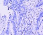 ERG Antibody in Immunohistochemistry (Paraffin) (IHC (P))