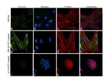 Collagen I Antibody in Immunocytochemistry (ICC/IF)