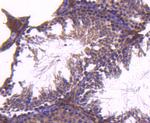 CD81 Antibody in Immunohistochemistry (Paraffin) (IHC (P))