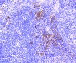 Dysferlin Antibody in Immunohistochemistry (Paraffin) (IHC (P))