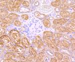 INSRR Antibody in Immunohistochemistry (Paraffin) (IHC (P))