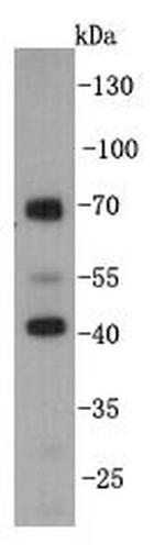KLDC3 Antibody in Western Blot (WB)