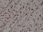 MYOD Antibody in Immunohistochemistry (Paraffin) (IHC (P))