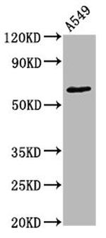 Phospho-PKC zeta (Thr560) Antibody in Western Blot (WB)