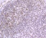MATR3 Antibody in Immunohistochemistry (Paraffin) (IHC (P))
