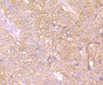 MAPRE3 Antibody in Immunohistochemistry (Paraffin) (IHC (P))