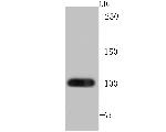 FZD8 Antibody in Western Blot (WB)