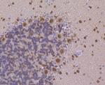 PEN2 Antibody in Immunohistochemistry (Paraffin) (IHC (P))