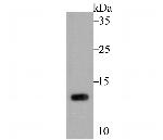PEN2 Antibody in Western Blot (WB)