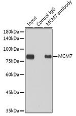 MCM7 Antibody in Immunoprecipitation (IP)