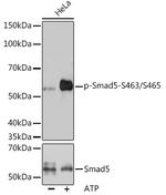 Phospho-Smad5 (Ser463,Ser465) Antibody in Western Blot (WB)