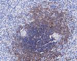 CD35 Antibody in Immunohistochemistry (Paraffin) (IHC (P))