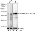 Phospho-VANGL2 (Ser79, Ser82, Ser84) Antibody in Western Blot (WB)