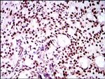 TWIST1 Antibody in Immunohistochemistry (Paraffin) (IHC (P))
