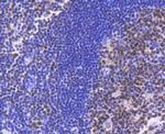 BRG1 Antibody in Immunohistochemistry (Paraffin) (IHC (P))