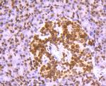 Histone H2A.X Antibody in Immunohistochemistry (Paraffin) (IHC (P))
