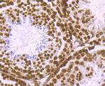 Histone H2A.X Antibody in Immunohistochemistry (Paraffin) (IHC (P))