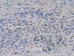 IGFBP4 Antibody in Immunohistochemistry (Paraffin) (IHC (P))