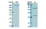 Clazakizumab Antibody in SDS-PAGE (SDS-PAGE)