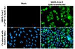 SARS/SARS-CoV-2 Spike Protein S2 Antibody in Immunocytochemistry (ICC/IF)