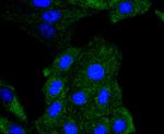 Phospho-PDGFRB (Tyr740) Antibody in Immunocytochemistry (ICC/IF)