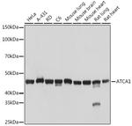 ACTA1 Antibody in Western Blot (WB)