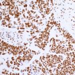 BRD4 Antibody in Immunohistochemistry (Paraffin) (IHC (P))