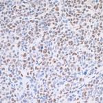 TRAP220 Antibody in Immunohistochemistry (Paraffin) (IHC (P))