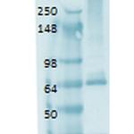 SLC5A5 Antibody in Western Blot (WB)