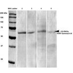 CACNG2/4/8 Antibody in Western Blot (WB)