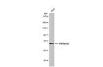 PIP5K1A Antibody in Western Blot (WB)