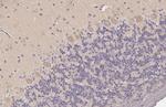 WNK1 Antibody in Immunohistochemistry (Paraffin) (IHC (P))