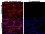 EpCAM Antibody in Immunohistochemistry (Paraffin) (IHC (P))