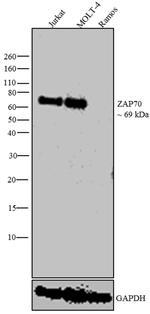 Zap-70 Antibody in Western Blot (WB)