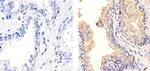 TIMP1 Antibody in Immunohistochemistry (Paraffin) (IHC (P))