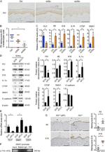Cytokeratin 16 Antibody in Immunohistochemistry (IHC)