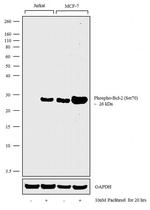Phospho-Bcl-2 (Ser70) Antibody