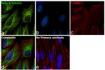 beta-4 Tubulin Antibody in Immunocytochemistry (ICC/IF)