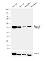 Ephrin B2 Antibody in Western Blot (WB)