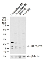 RAC1/RAC2/RAC3 Recombinant Rabbit Monoclonal Antibody (16D14)