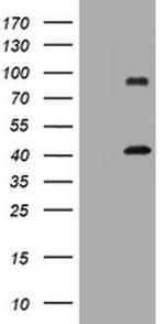 MAGEA9 Antibody in Western Blot (WB)