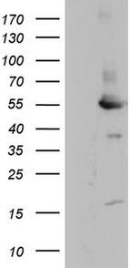 MAPKAPK5 Antibody in Western Blot (WB)