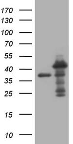 MED27 Antibody in Western Blot (WB)